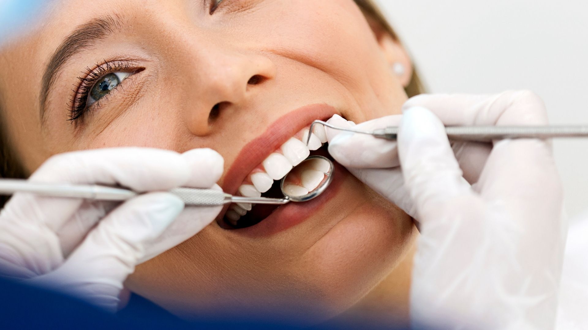 Conservative Treatments