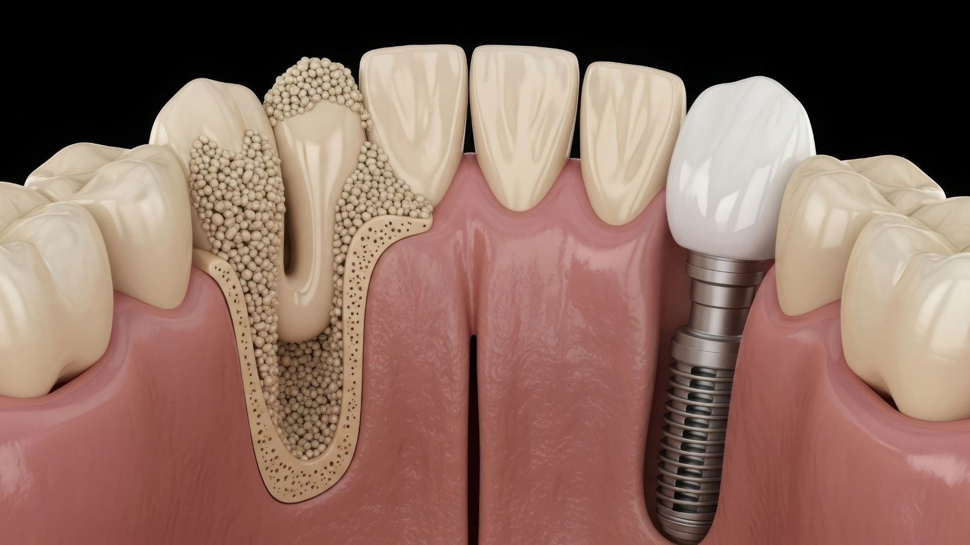 Oral and Maxillofacial Surgery